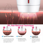 SilkBeam Home Laser Hair Removal Device