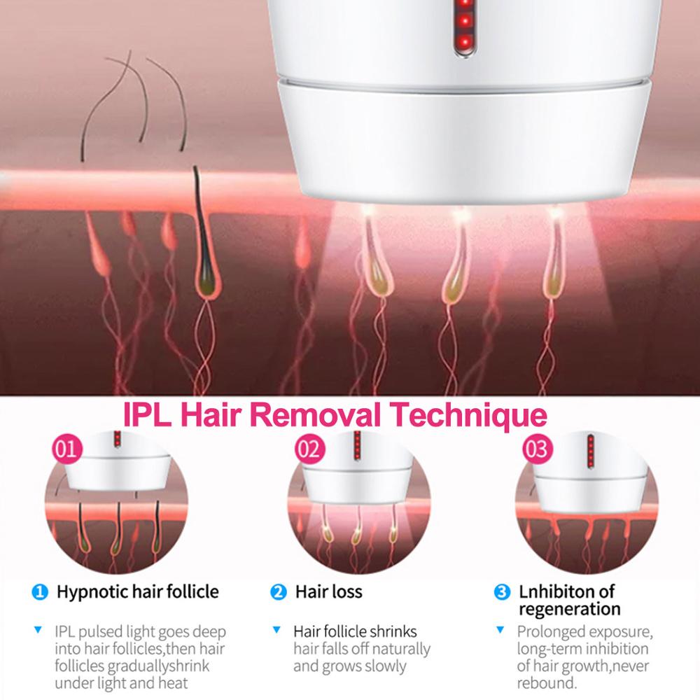 SilkBeam Home Laser Hair Removal Device